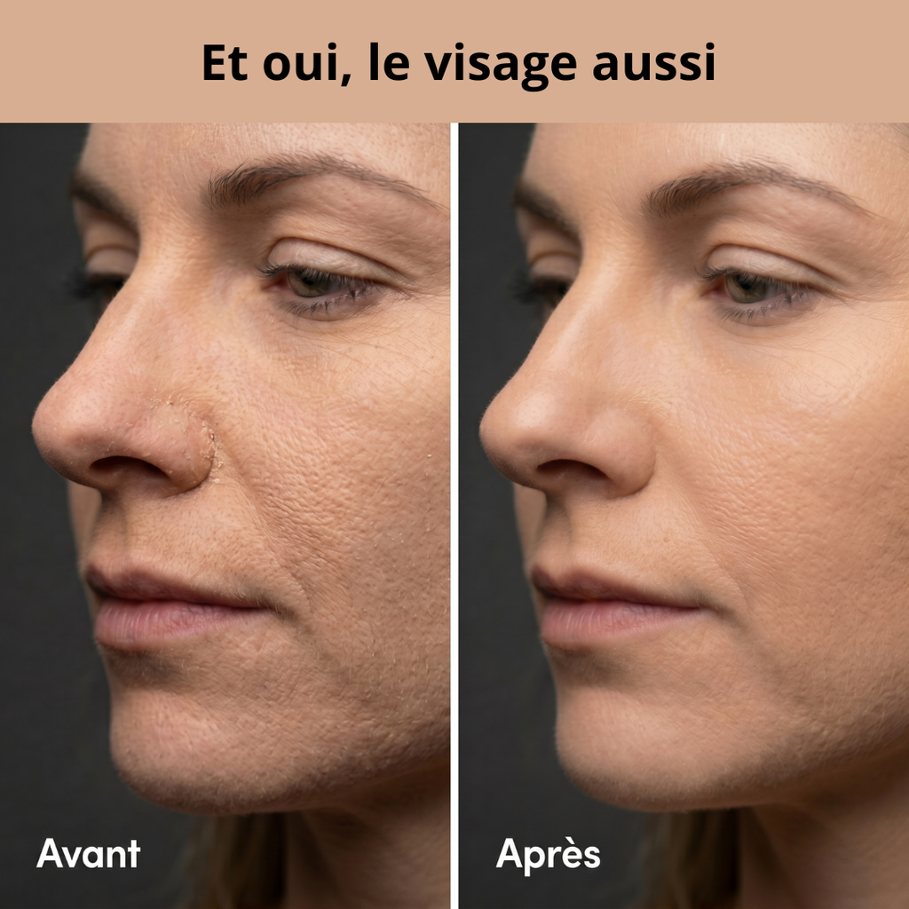 Exvolia - Serviette Exfoliante