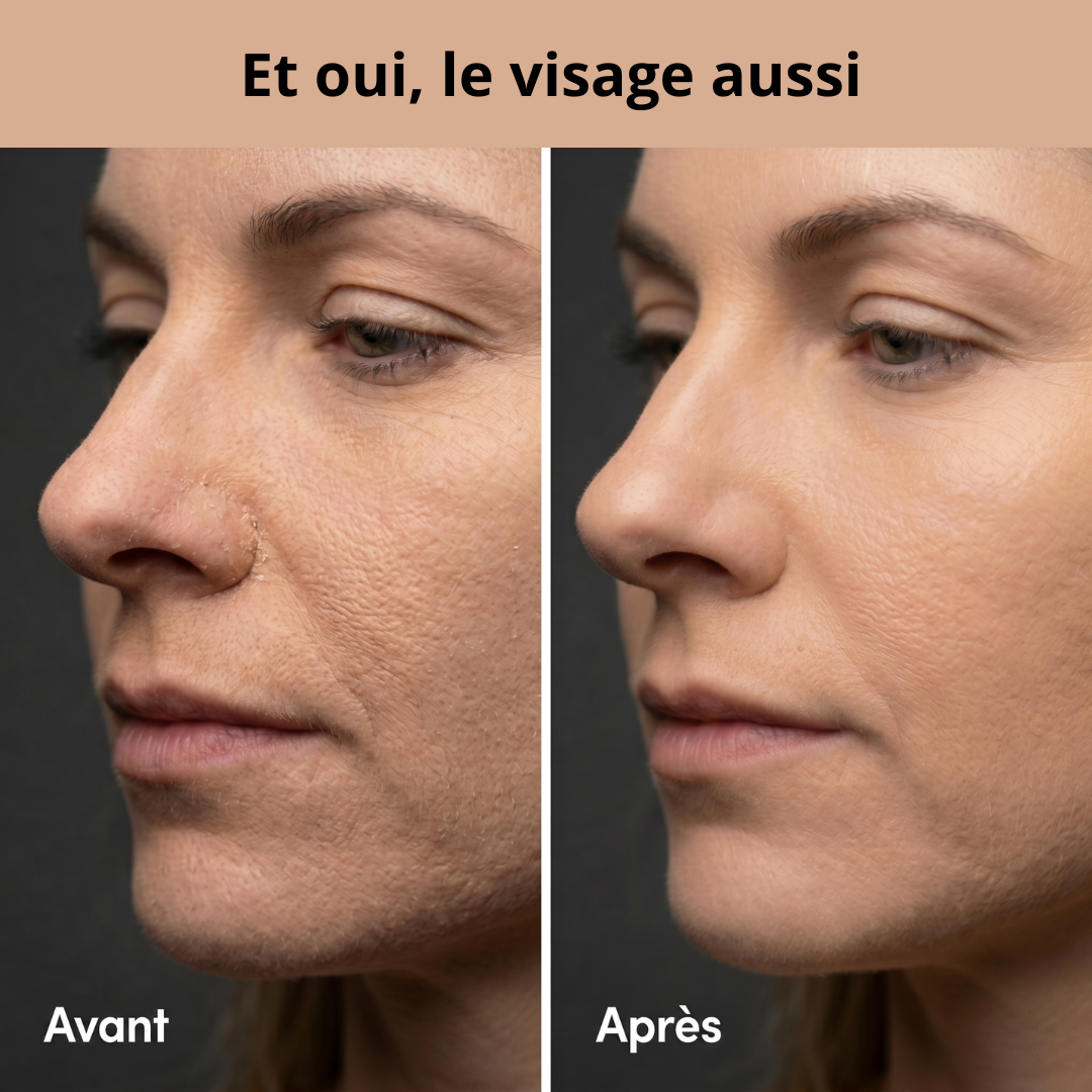 Exvolia - Serviette Exfoliante